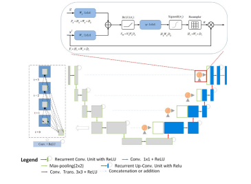 Multi-task learning for video anomaly detection